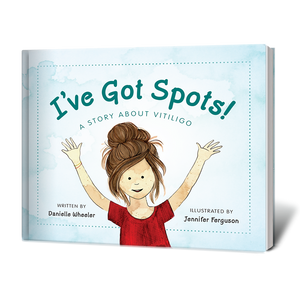 I've Got Spots! A Story about Vitiligo