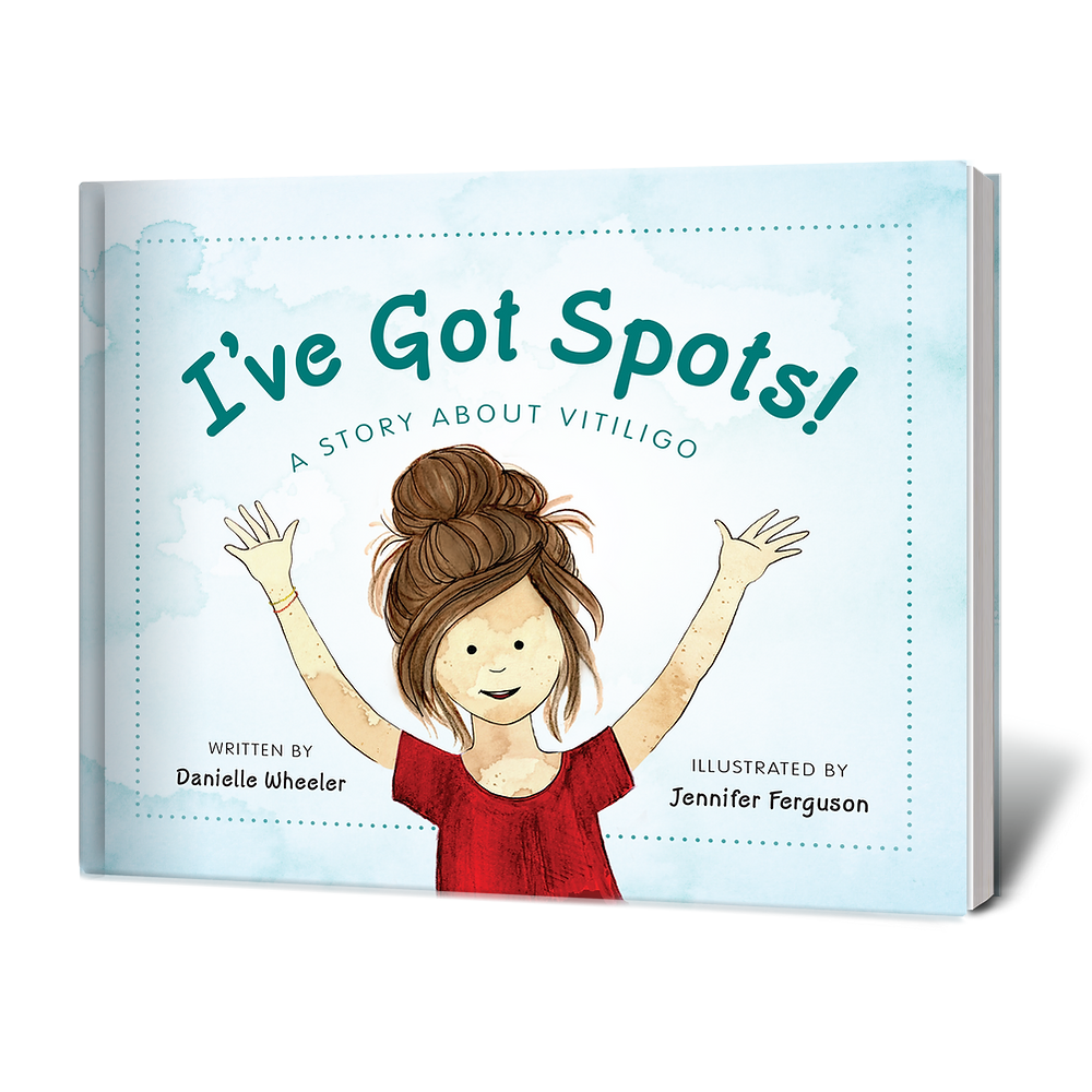 I've Got Spots! A Story about Vitiligo